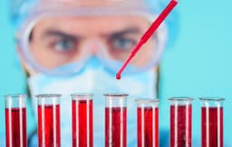 HUTCHMED Reports Phase 3 Data for Sovleplenib, Plans NDA Submission in 2026