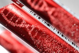 an image of Guardant Health (GH) Receives FDA Approval for Guardant360 CDx Diagnostic to Enhance Colorectal Cancer Treatment