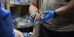 Benchmark Reaffirms Buy Rating on Humacyte, Adjusts Price Target to $11